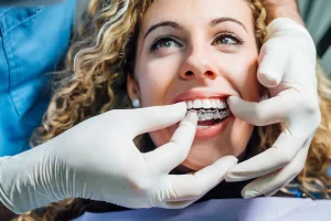 Can I Drink Coffee While Wearing My Invisalign Trays?