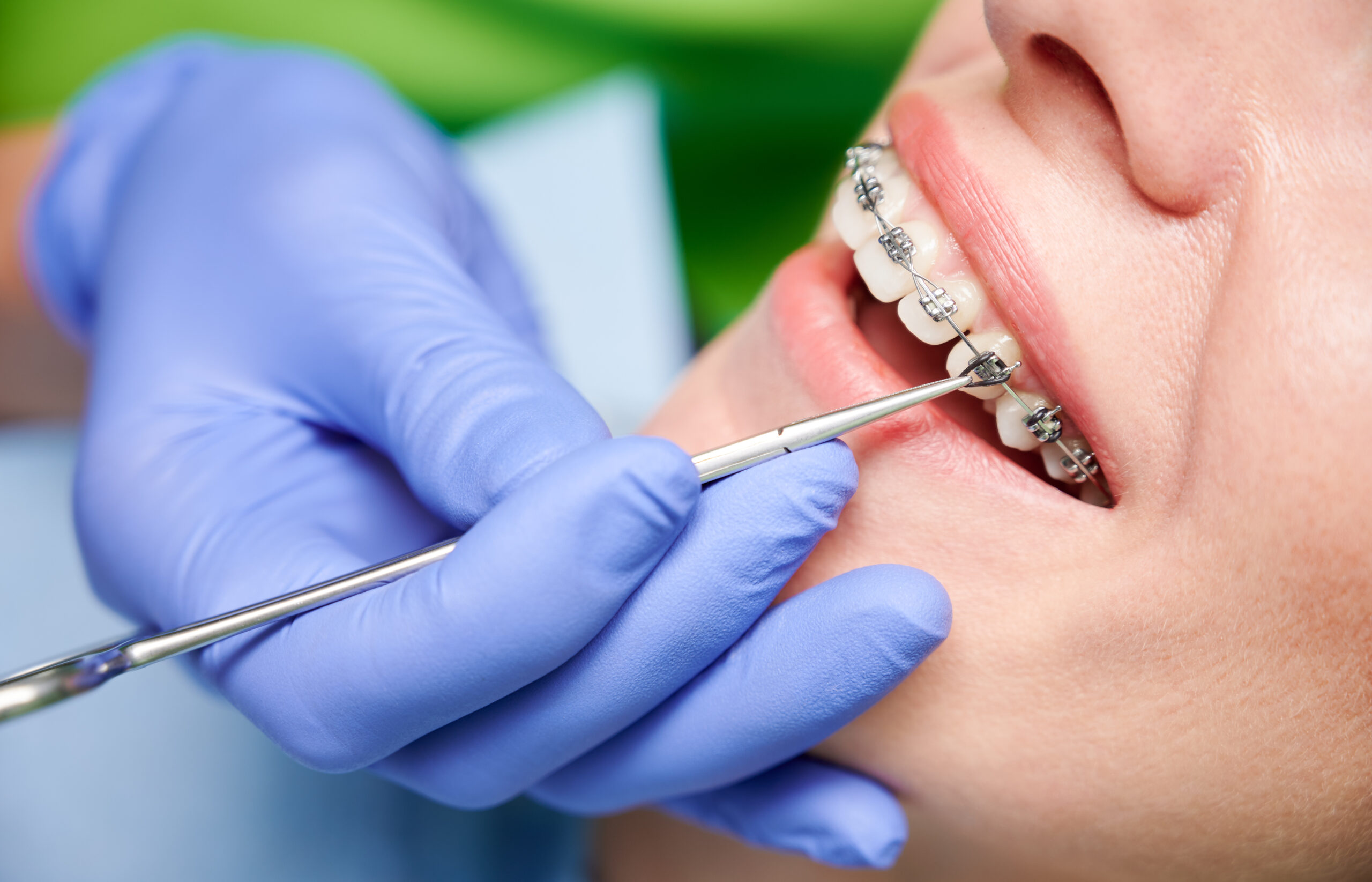 La Verne orthodontist